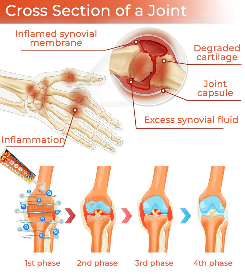 Fivfivgo™ Arthritis Cream (Neck & Back & Knee Relief)