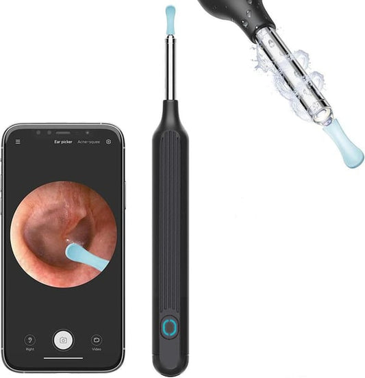 (🔥Last Day Promotion- SAVE 48% OFF)1080P Ear Wax Removal Camera