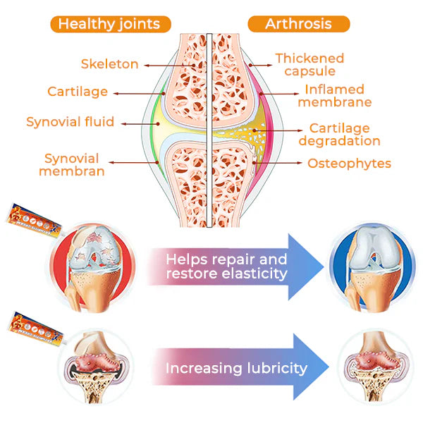 Fivfivgo™ Arthritis Cream (Neck & Back & Knee Relief)