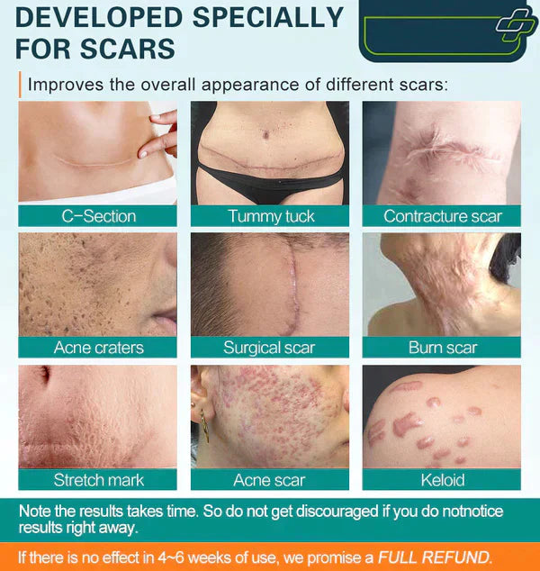 Scar Removal Spray