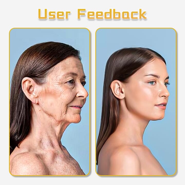 parioliy™ UltraRenew Ultrasonic Facelift Device