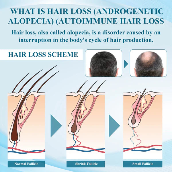 ATTDX™ Alopecia Recovery Hair Regrowth Cream