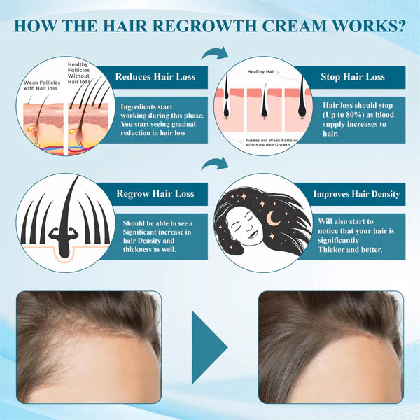 ATTDX™ Alopecia Recovery Hair Regrowth Cream