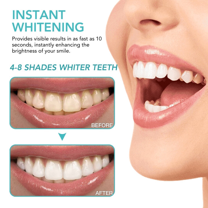 Oveallgo™ Instant Teeth Whitening Paint