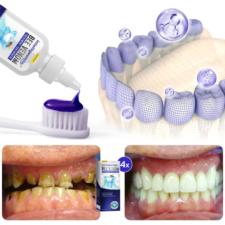 Fivfivgo™ Intelligent Smile Bee Venom Treatment Toothpaste