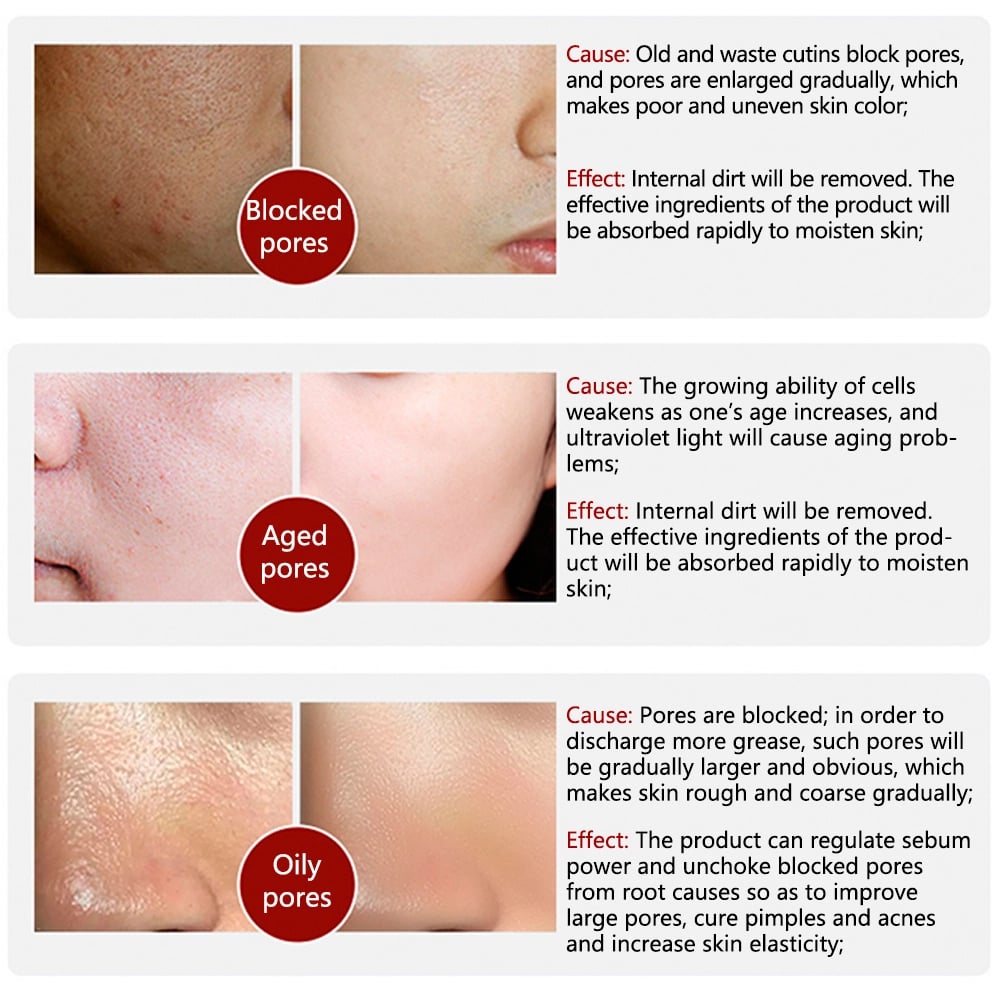 💥HOT SALE - -2024 New Magical Pore Eraser Waterproof Face  Primer Stick